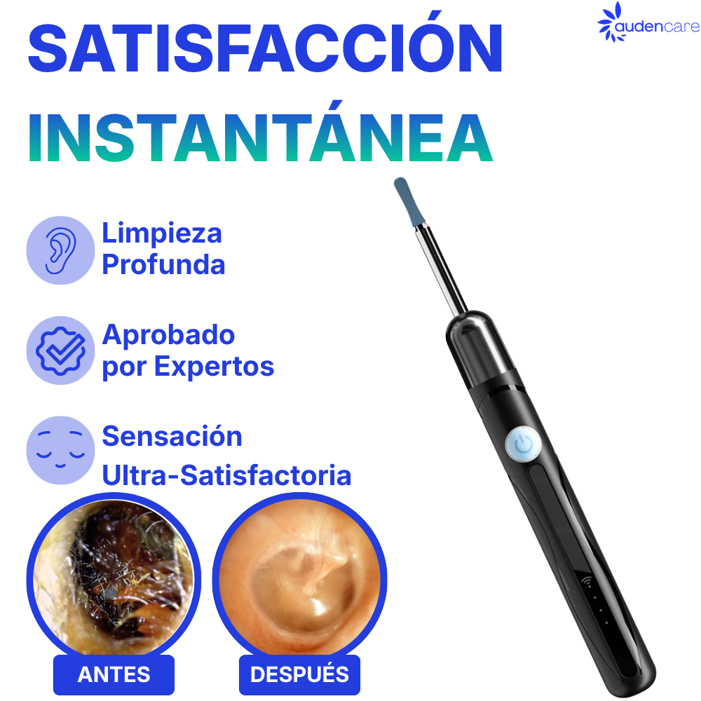 Auden One™ - Limpiador de Oídos con Cámara