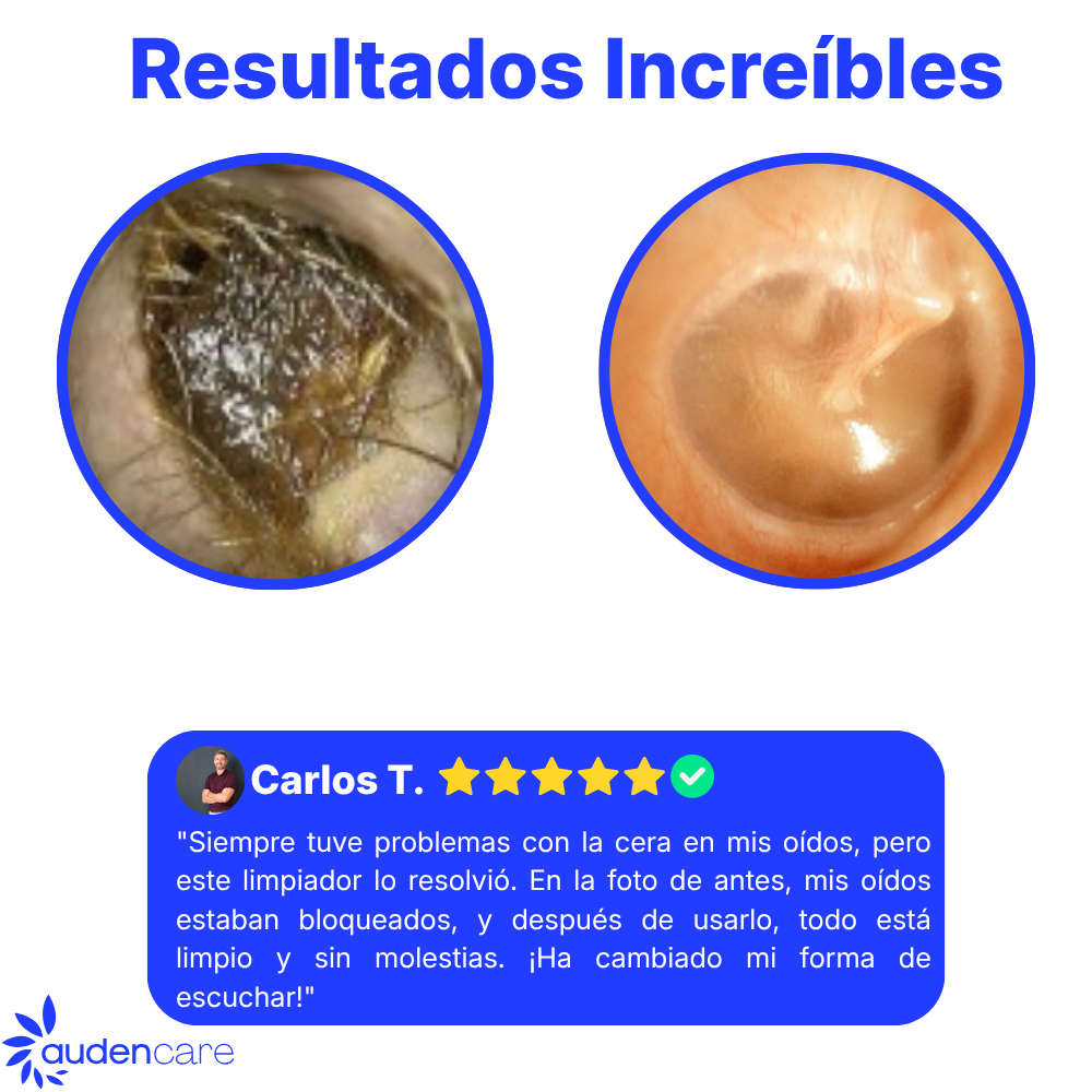 Auden One™ - Limpiador de Oídos con Cámara